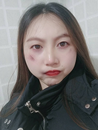 辽宁女孩求长期包养资助，合适可以去外地。 第1张